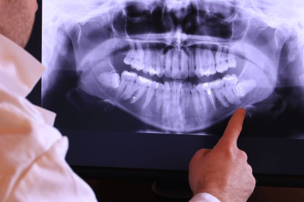 Best Dental Abscess Treatment in Boling, TX