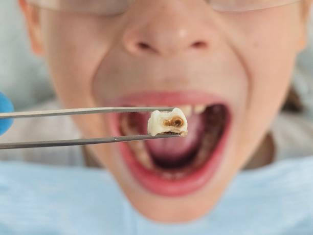 Best Walk-In Emergency Dental Services in Boling, TX